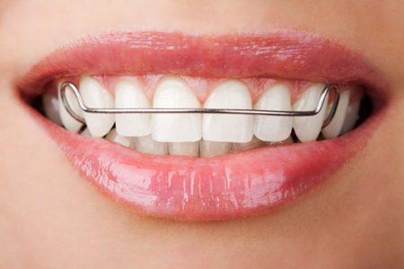 Aparelho Ortopédico