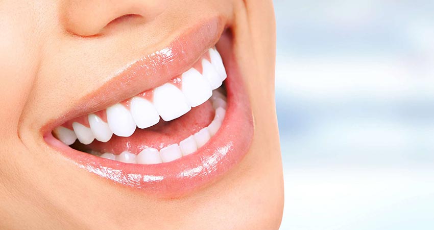 Lentes de Contato Dental