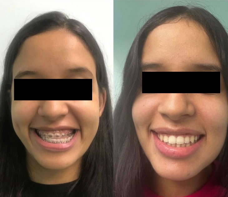 Cirurgia Ortognática