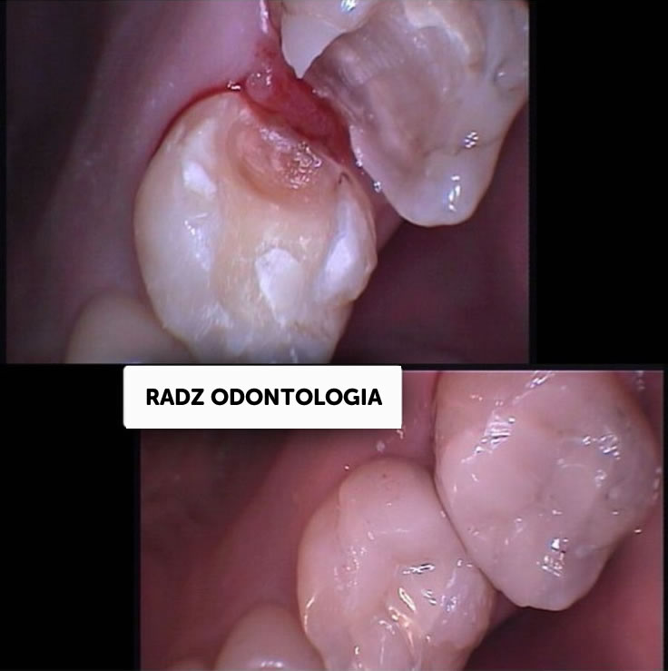 Restauração Estética