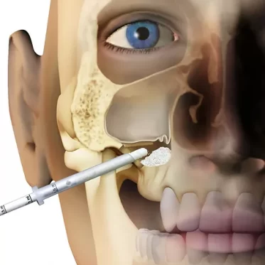 Reconstruções Ósseas